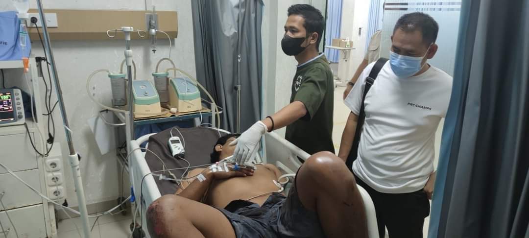 Ibu di Bungo disiram anaknya dengan air panas